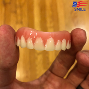 InstantSmile® Veneers