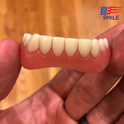 InstantSmile® Veneers